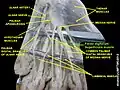 Flexor digitorum superficialis muscle