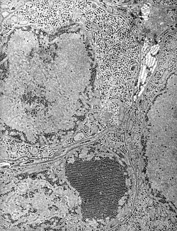 Electron micrograph of Saint Louis encephalitis virus seen in a mosquito salivary gland
