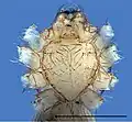 Ventral detailed view of a male's prosoma