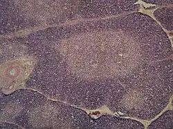 Micrograph showing a lobule of the thymus. The cortex (deeper purple area) surrounds a less dense and lighter medulla.