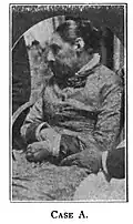 55-year-old female, 1920
