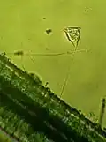 Vorticella protozoa
