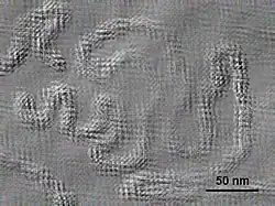 Electron micrograph of Citrus psorosis virus