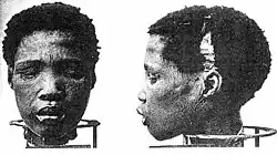 A black and white photo depicting the severed head of a Shark Island prisoner, which was used for medical experimentation