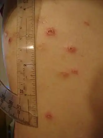 Description de cette image, également commentée ci-après