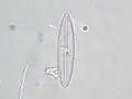 Navicula tripunctata.