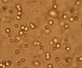 Description de l'image Pyuria.JPG.
