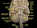 Cerebrum. Vue inférieure. Dissection profonde.