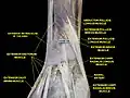 Rétinaculum extenseur de la main.Dissection profonde.