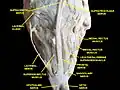 Muscle oculaire extrinsèque. Nerfs de l'orbite. Dissection profonde.