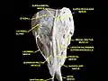 Vue supérieure d'une dissection de l'orbite. Le nerf frontal est visible en se ramifiant dans les nerfs supratrochléaire et supraorbitaire.