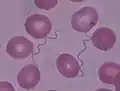 Deux spirochètes, dans un frottis sanguin, au milieu de globules rouges