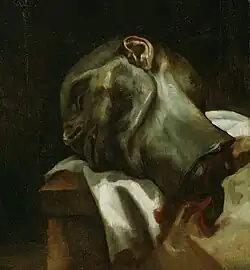 Géricault (?), Tête d'un homme guillotiné, Art Institute of Chicago
