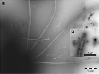 C. triciliatum Å85 (Detail). a: Die vier Geißeln, b: Spitze einer Geißel.[10]