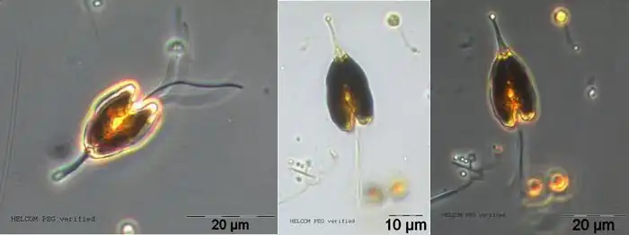 P. longicauda, Phasen­kontrast­mikro­skopie (PCM). Susanne Busch, via SMHI